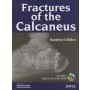 Fractures of the Calcaneus