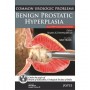 Common Urologic Problems Benign Prostatic Hyperplasia