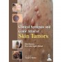 Clinical Synopsis and Color Atlas of Skin Tumors